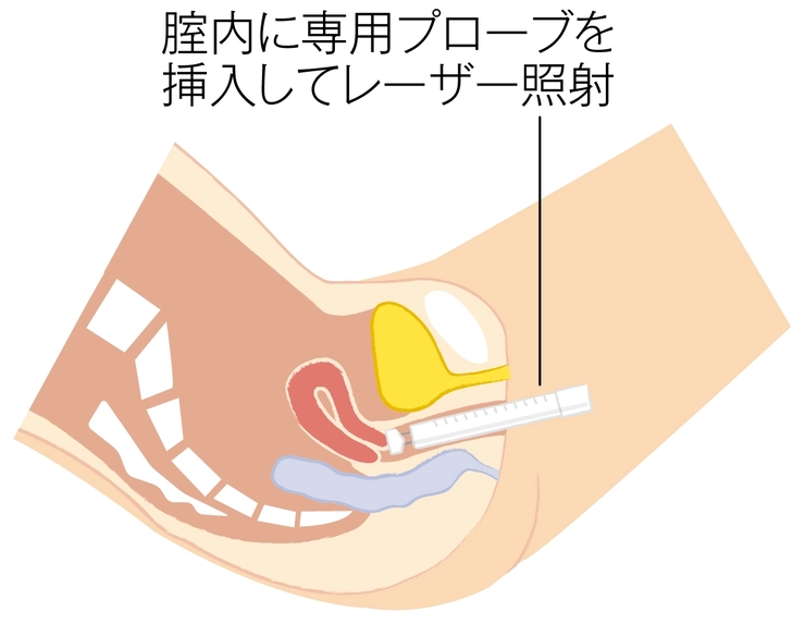 モナリザタッチ