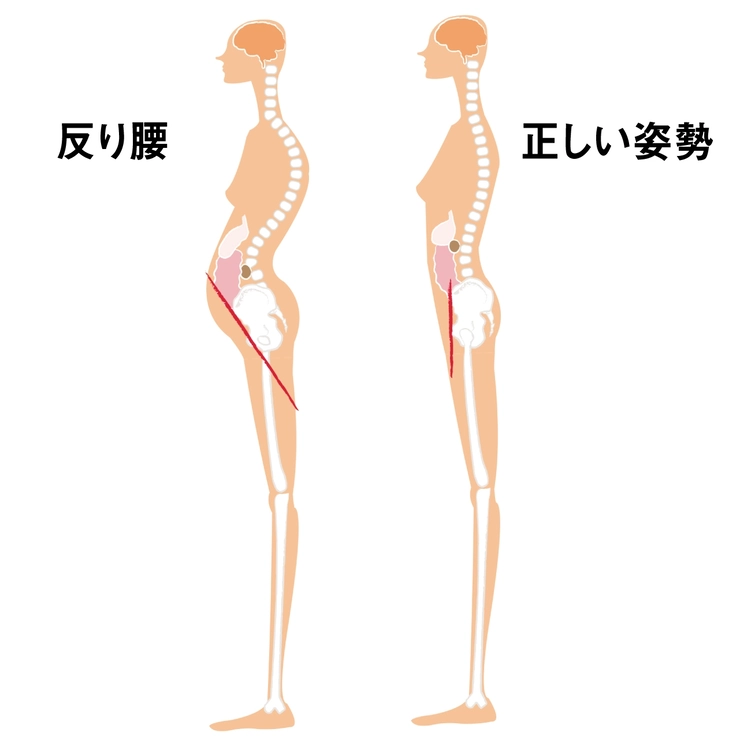 正しい姿勢と反り腰