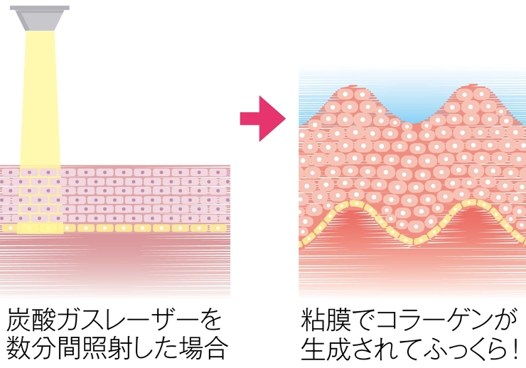 モナリザタッチの効果
