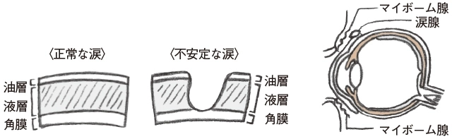 まぶたにある分泌腺と涙の質