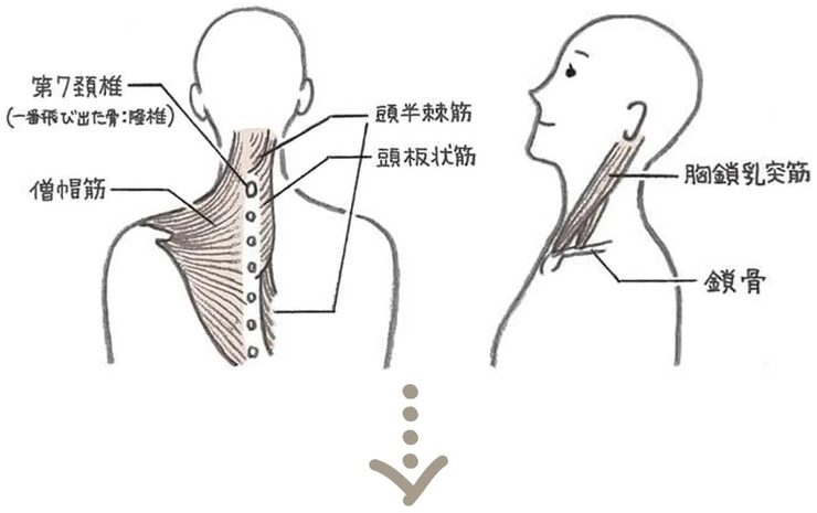 首こり病は首の筋肉硬化から