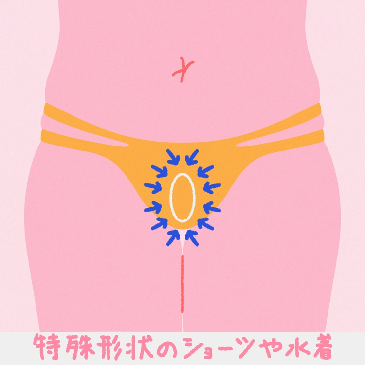アンダーヘアは残す? なくす? デザインする? ショーツのタイプ別 V・I・Oスタイル8選_4_8