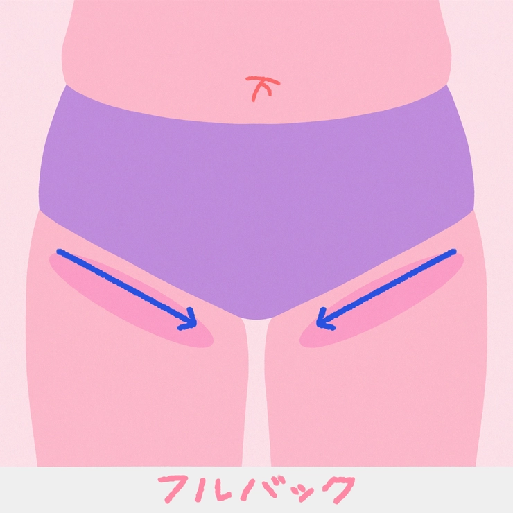 アンダーヘアは残す? なくす? デザインする? ショーツのタイプ別 V・I・Oスタイル8選_4_2