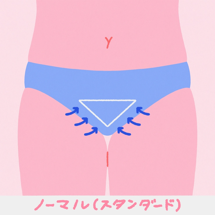 アンダーヘアは残す? なくす? デザインする? ショーツのタイプ別 V・I・Oスタイル8選_4_1